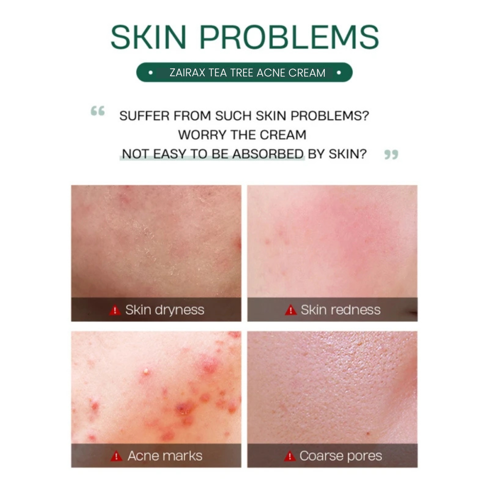 Tea Tree Acne Control Cream