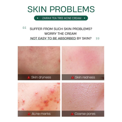 Tea Tree Acne Control Cream